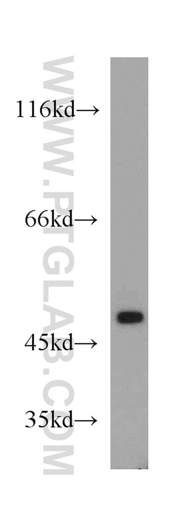 PTP1B Antibody in Western Blot (WB)