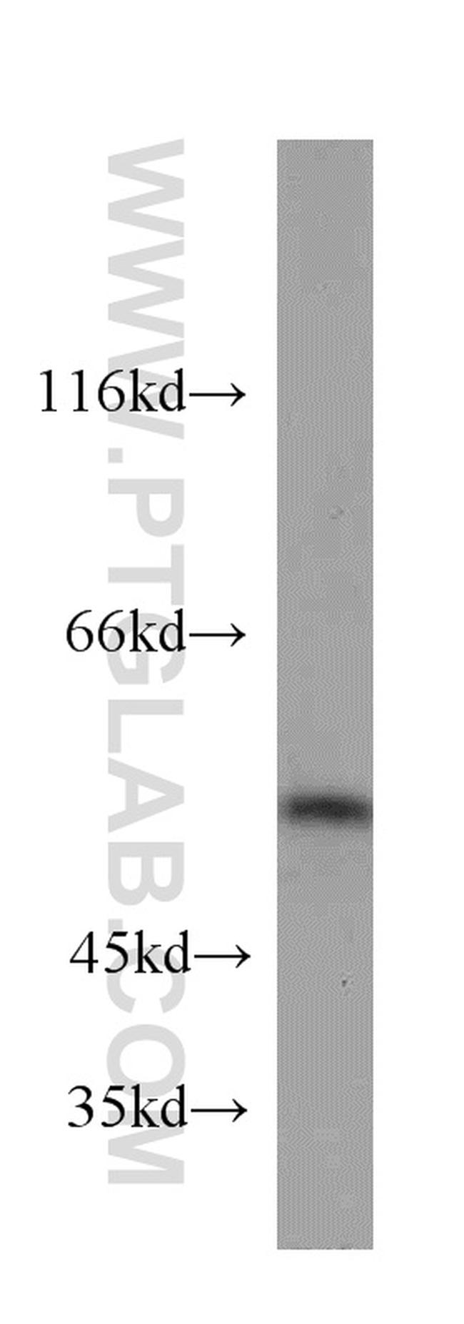 PTP1B Antibody in Western Blot (WB)