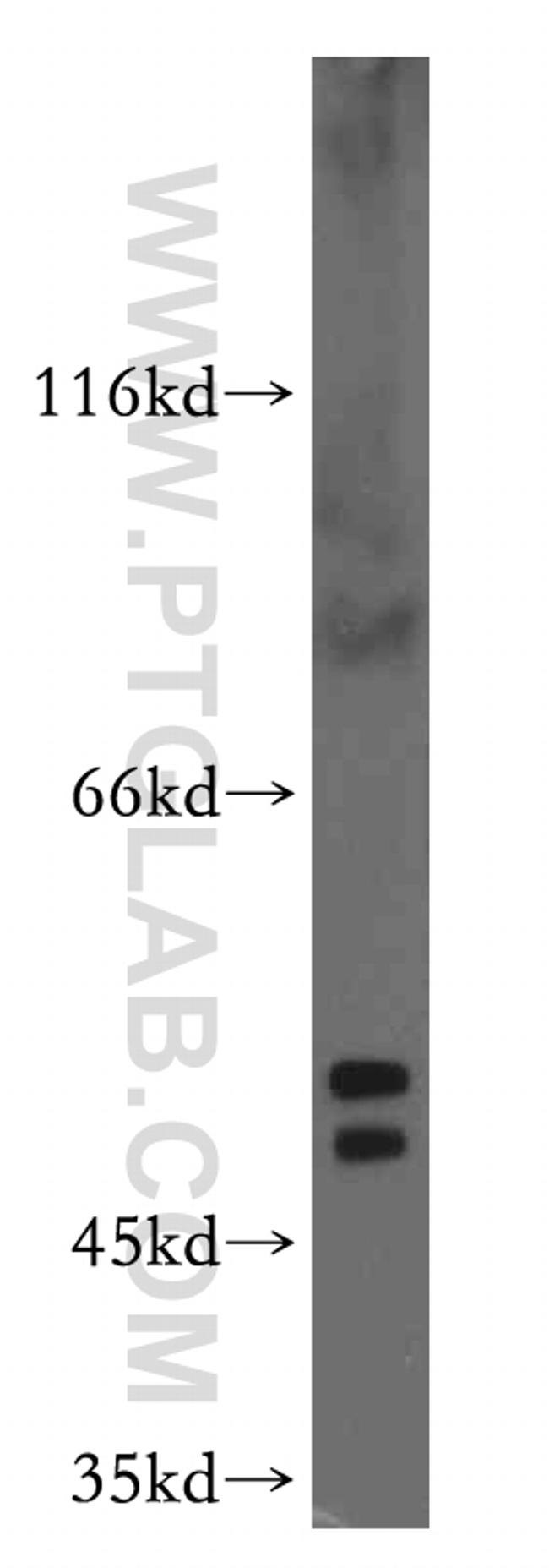 PTP1B Antibody in Western Blot (WB)