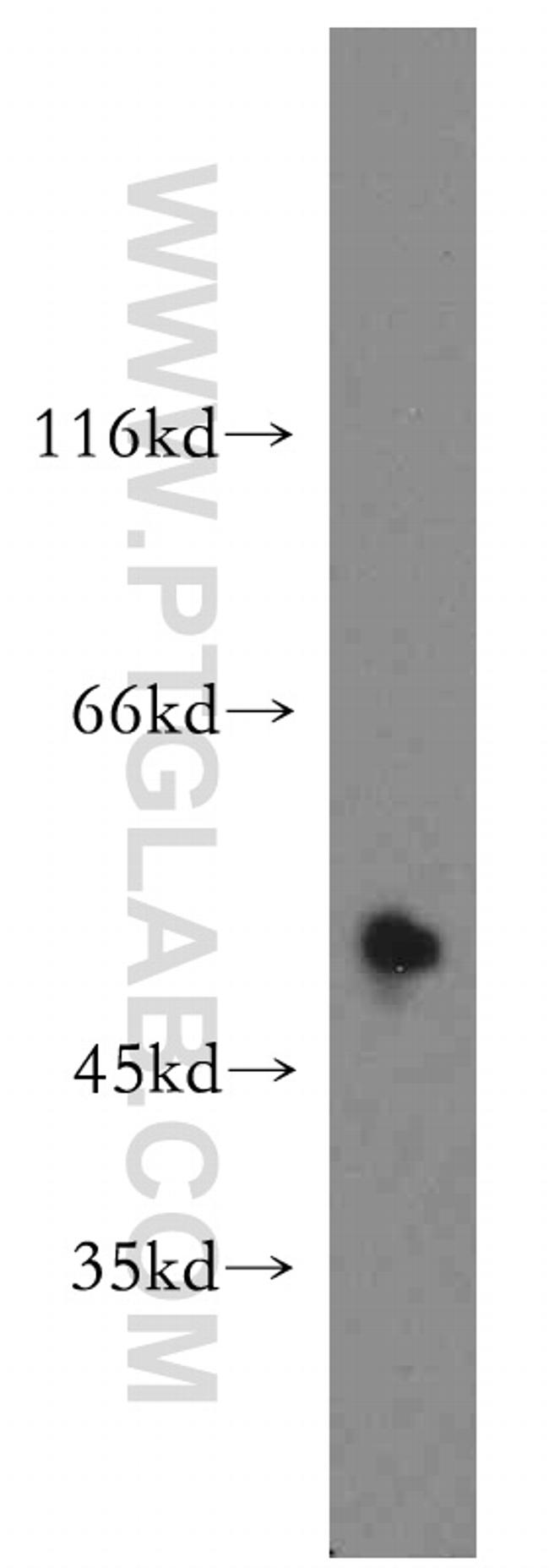 PTP1B Antibody in Western Blot (WB)