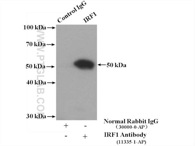 IRF1 Antibody in Immunoprecipitation (IP)