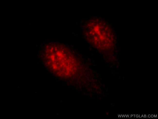 HOP2 Antibody in Immunocytochemistry (ICC/IF)