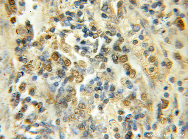 HOP2 Antibody in Immunohistochemistry (Paraffin) (IHC (P))