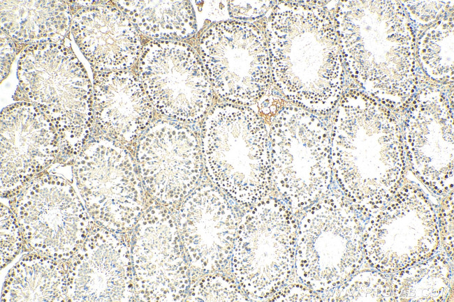 HOP2 Antibody in Immunohistochemistry (Paraffin) (IHC (P))