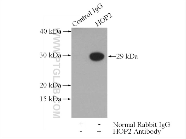 HOP2 Antibody in Immunoprecipitation (IP)