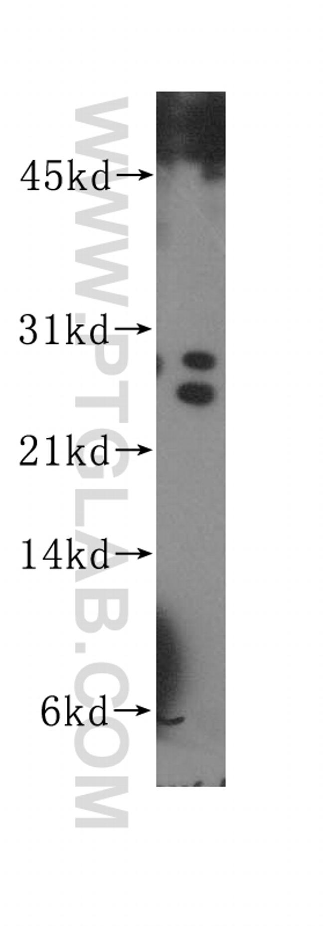 HOP2 Antibody in Western Blot (WB)