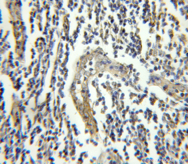 FGFR1OP Antibody in Immunohistochemistry (Paraffin) (IHC (P))