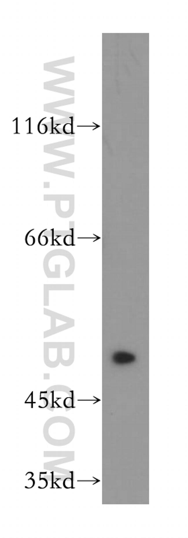 FGFR1OP Antibody in Western Blot (WB)