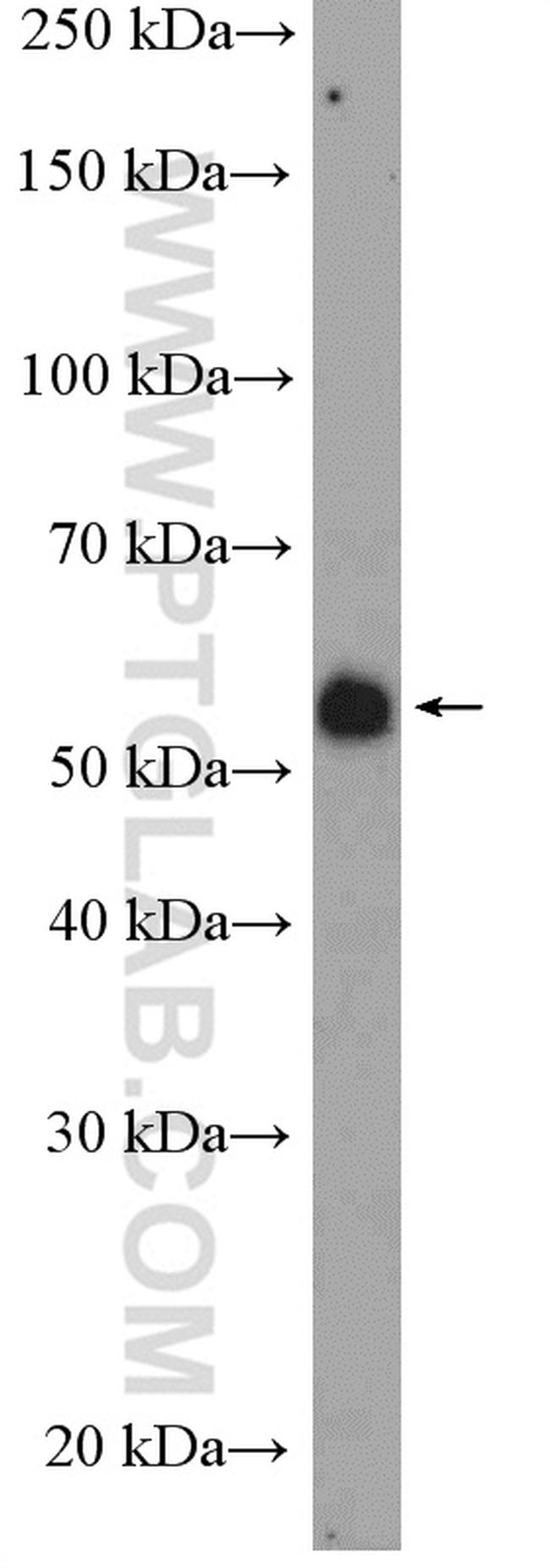 FGFR1OP Antibody in Western Blot (WB)