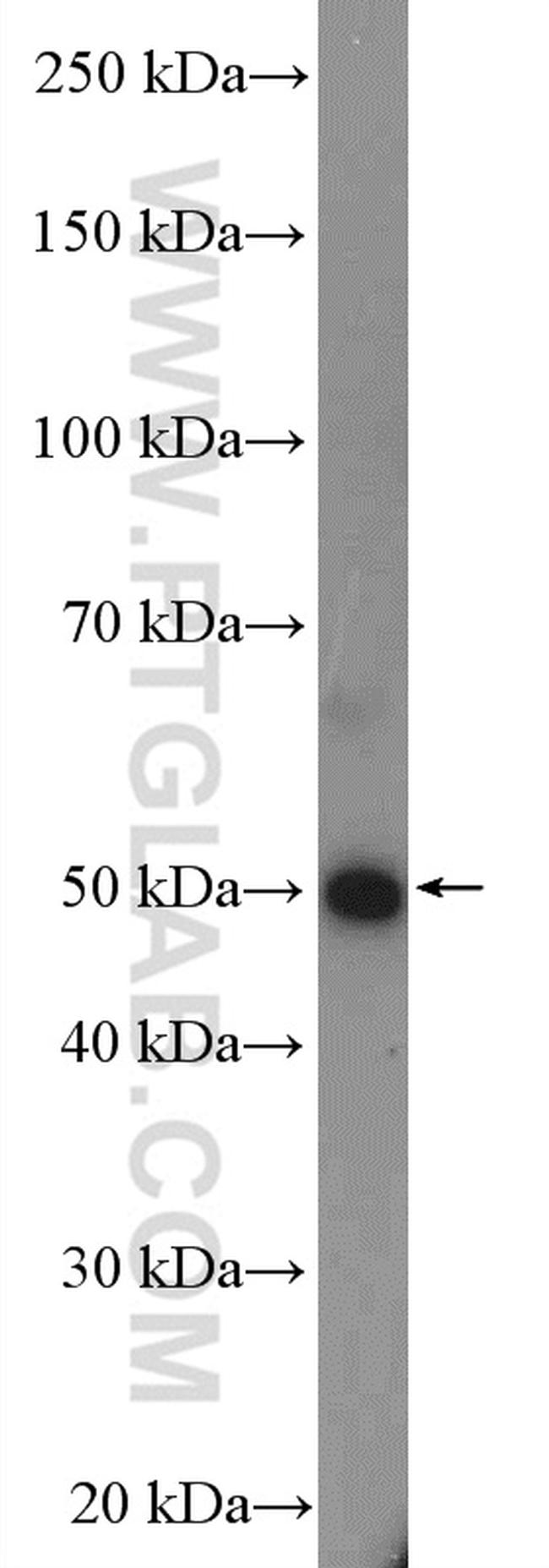 FGFR1OP Antibody in Western Blot (WB)