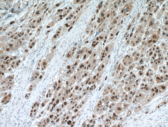 HDGF Antibody in Immunohistochemistry (Paraffin) (IHC (P))