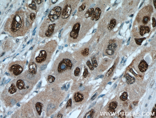 HDGF Antibody in Immunohistochemistry (Paraffin) (IHC (P))