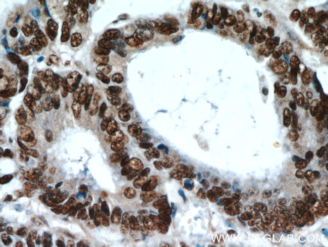 HDGF Antibody in Immunohistochemistry (Paraffin) (IHC (P))