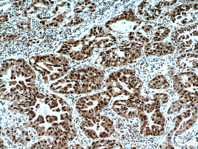 HDGF Antibody in Immunohistochemistry (Paraffin) (IHC (P))