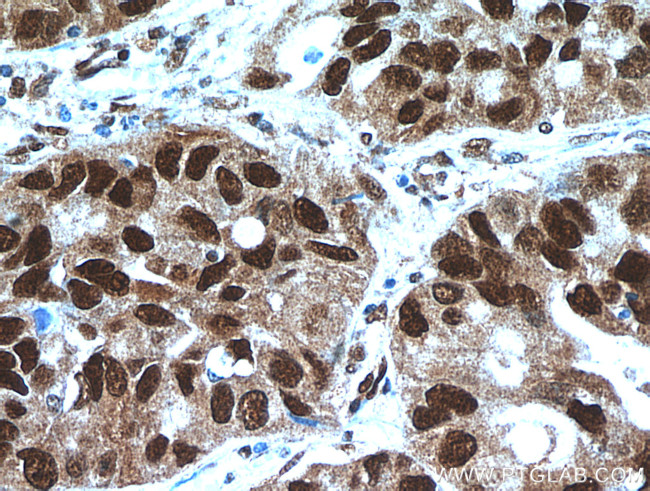 HDGF Antibody in Immunohistochemistry (Paraffin) (IHC (P))