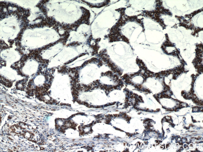 HDGF Antibody in Immunohistochemistry (Paraffin) (IHC (P))