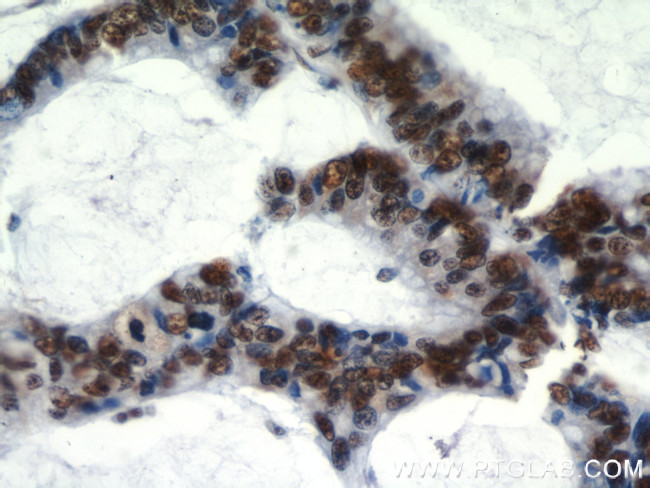 HDGF Antibody in Immunohistochemistry (Paraffin) (IHC (P))