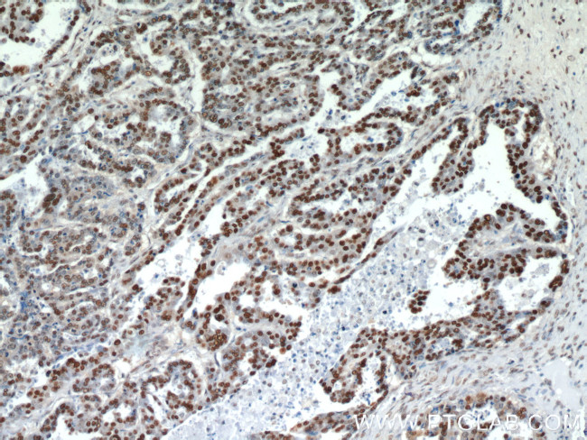 HDGF Antibody in Immunohistochemistry (Paraffin) (IHC (P))