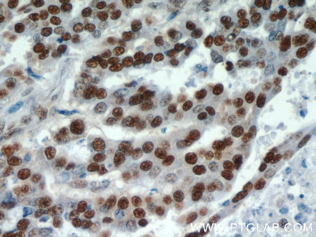 HDGF Antibody in Immunohistochemistry (Paraffin) (IHC (P))