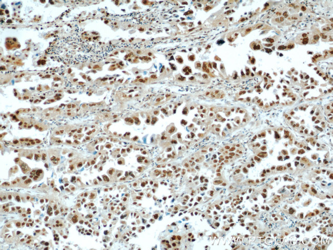 HDGF Antibody in Immunohistochemistry (Paraffin) (IHC (P))