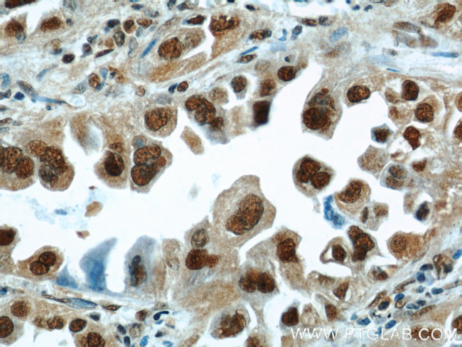 HDGF Antibody in Immunohistochemistry (Paraffin) (IHC (P))