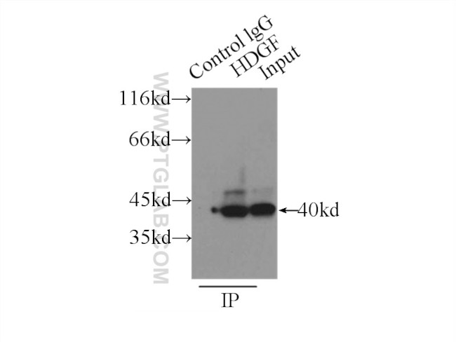 HDGF Antibody in Immunoprecipitation (IP)