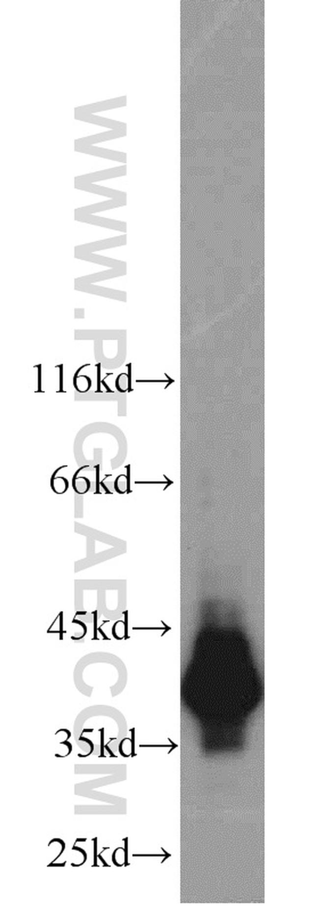 HDGF Antibody in Western Blot (WB)