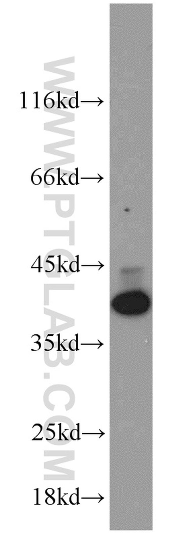 HDGF Antibody in Western Blot (WB)