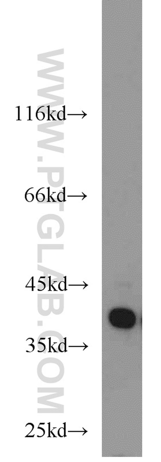 HDGF Antibody in Western Blot (WB)