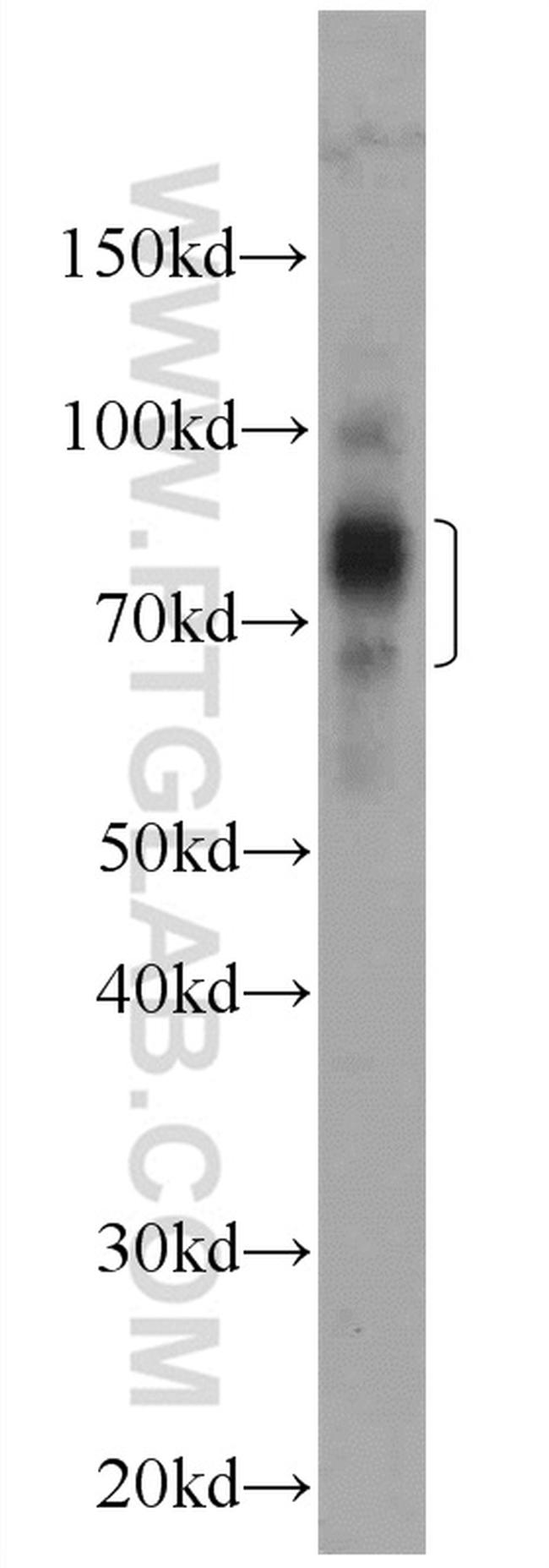 NSD3 Antibody in Western Blot (WB)