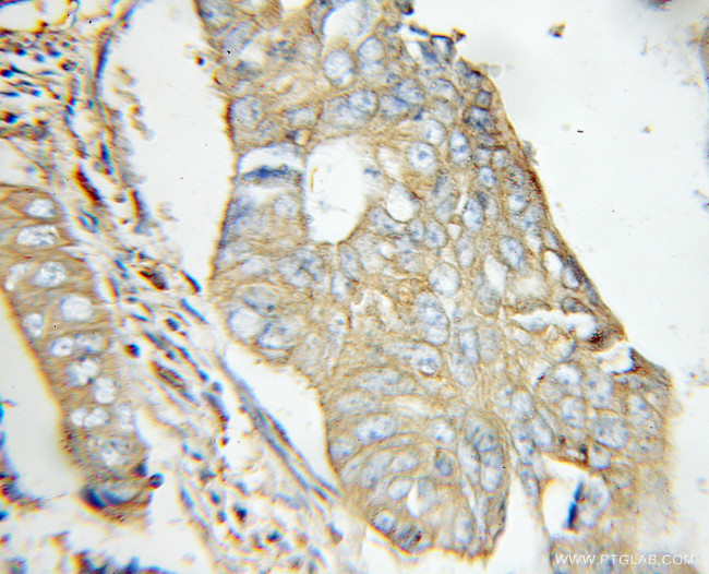 EXT2 Antibody in Immunohistochemistry (Paraffin) (IHC (P))