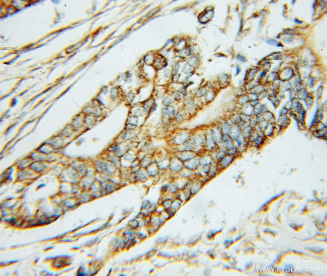 ABAT Antibody in Immunohistochemistry (Paraffin) (IHC (P))