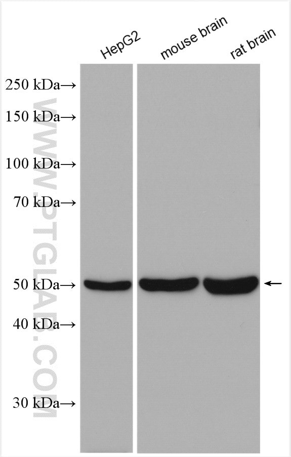 ABAT Antibody in Western Blot (WB)