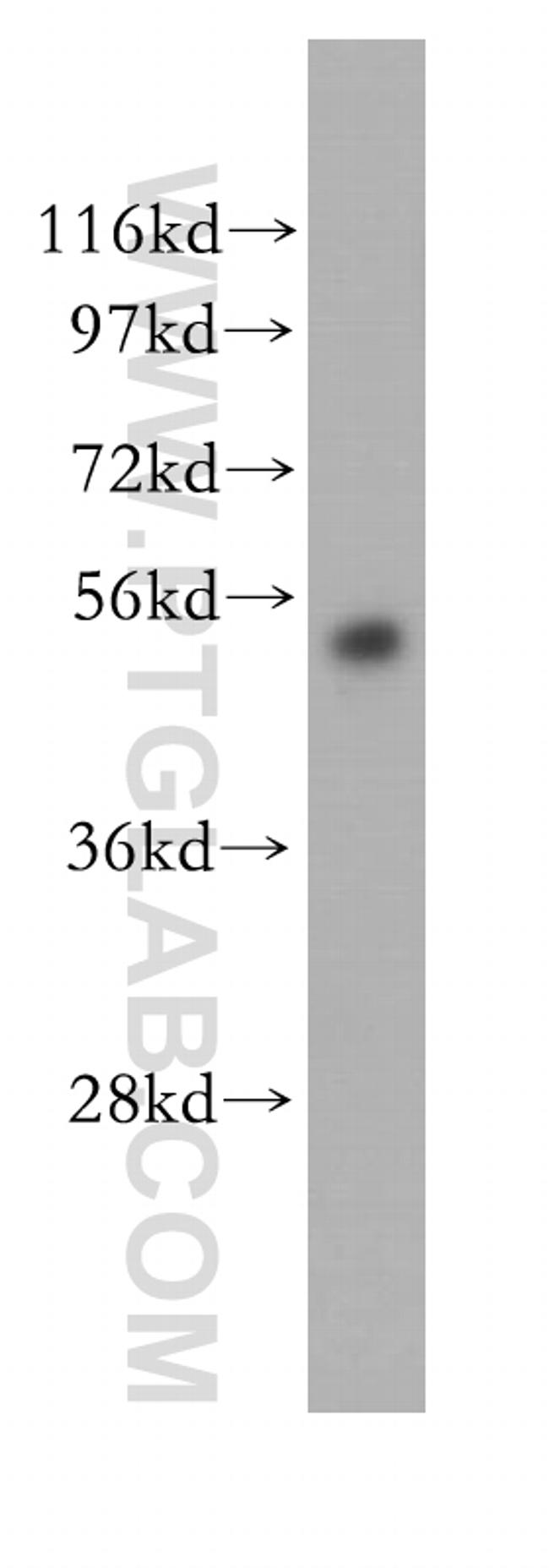 ABAT Antibody in Western Blot (WB)