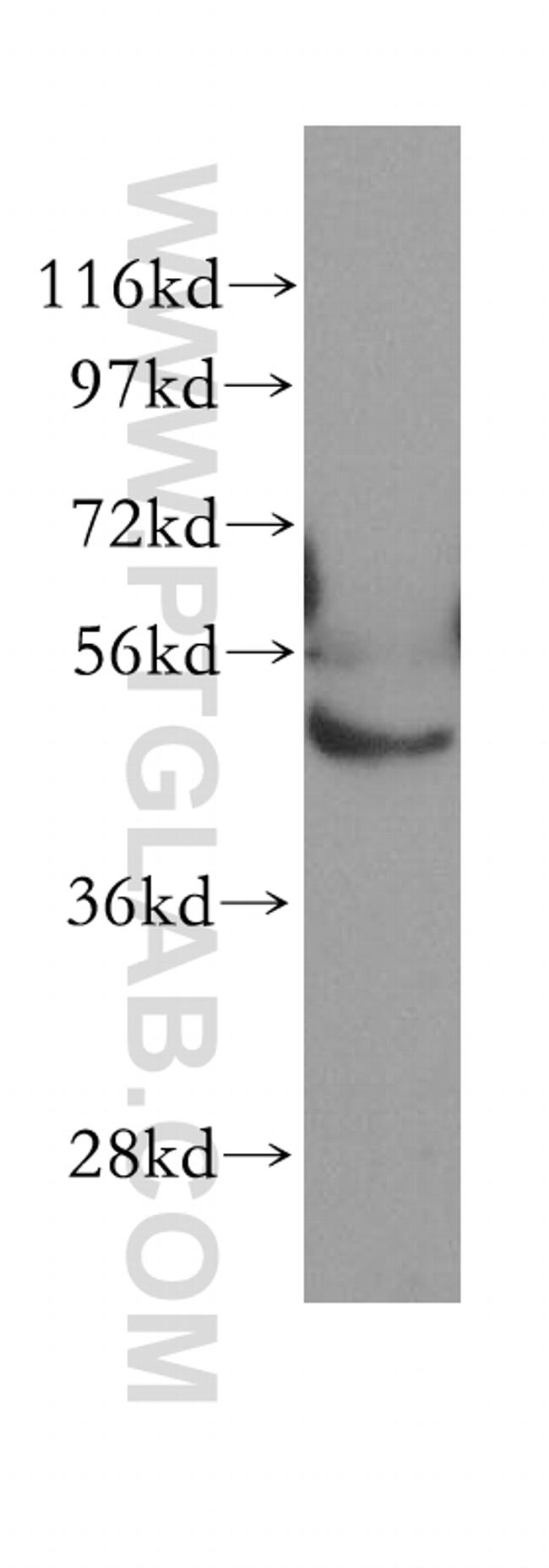 ABAT Antibody in Western Blot (WB)