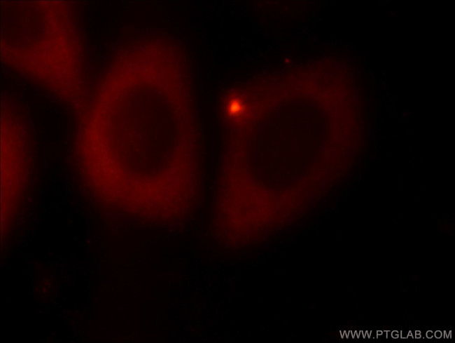 EIF3E Antibody in Immunocytochemistry (ICC/IF)