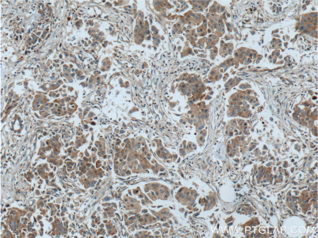 EIF3E Antibody in Immunohistochemistry (Paraffin) (IHC (P))