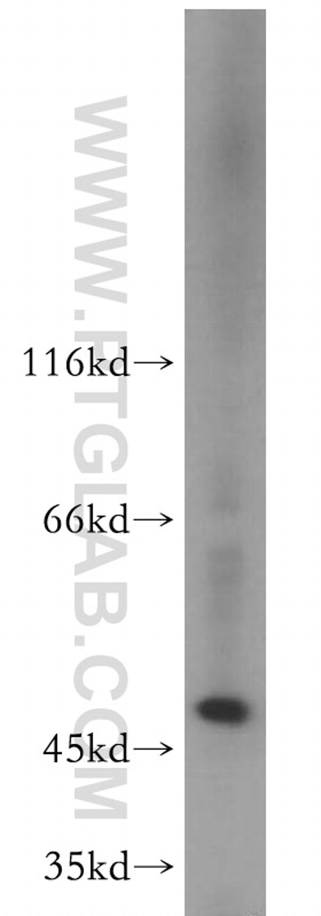 EIF3E Antibody in Western Blot (WB)