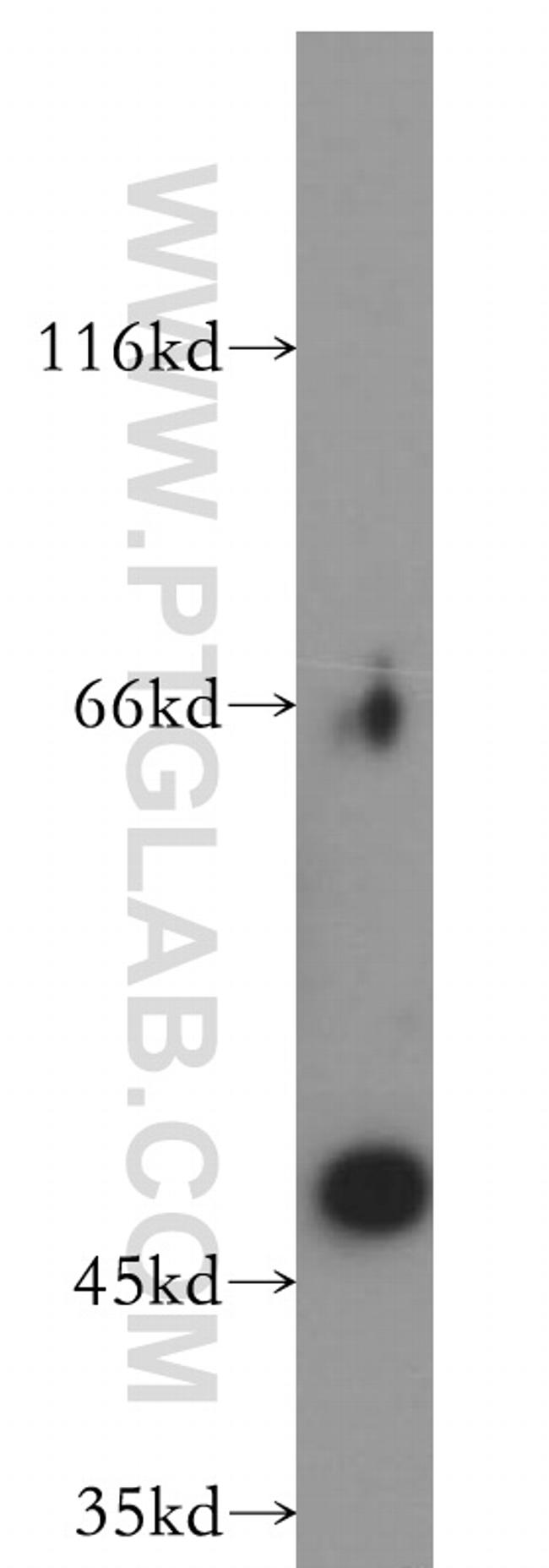 EIF3E Antibody in Western Blot (WB)