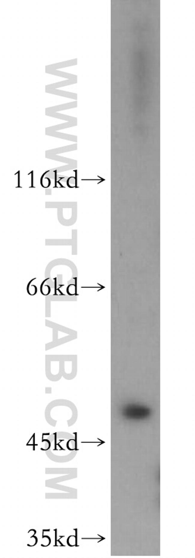 EIF3E Antibody in Western Blot (WB)