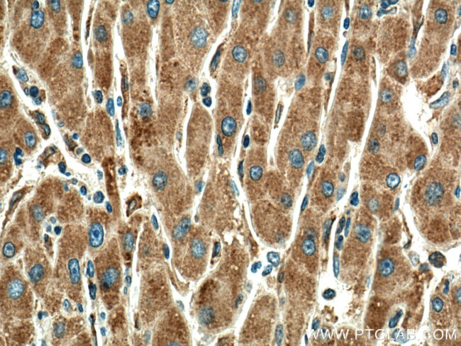 MYDGF Antibody in Immunohistochemistry (Paraffin) (IHC (P))