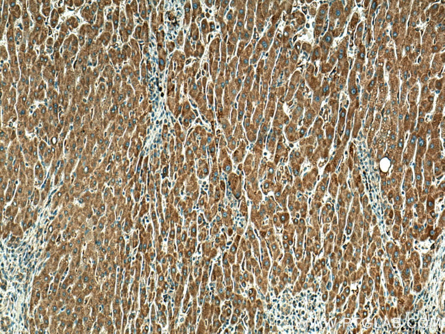 MYDGF Antibody in Immunohistochemistry (Paraffin) (IHC (P))