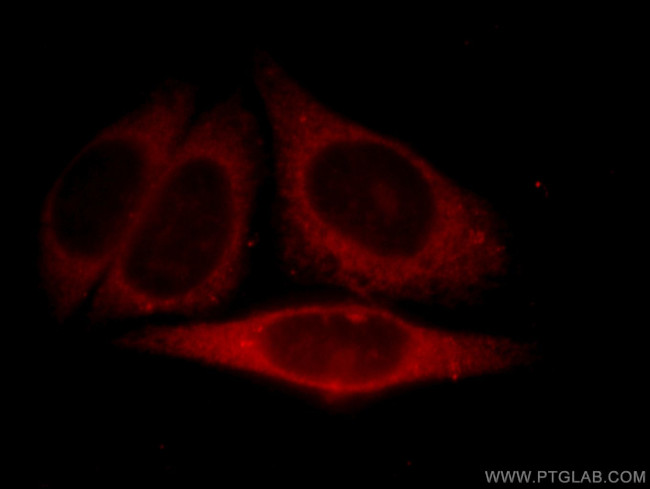 MYDGF Antibody in Immunocytochemistry (ICC/IF)