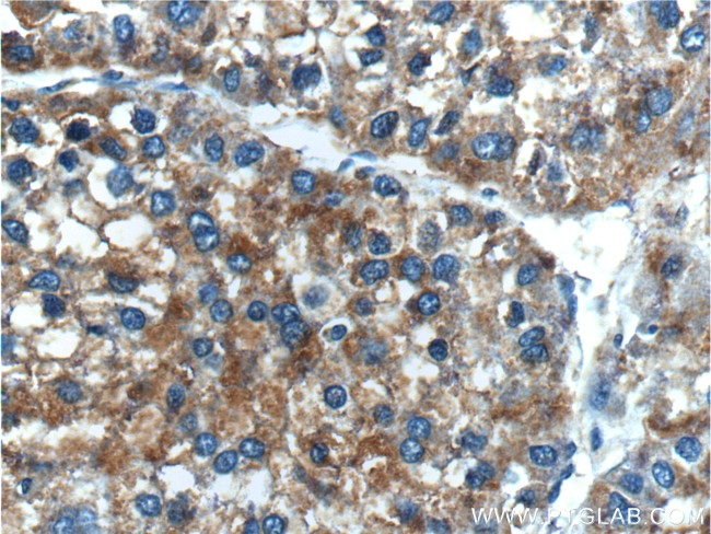 MYDGF Antibody in Immunohistochemistry (Paraffin) (IHC (P))