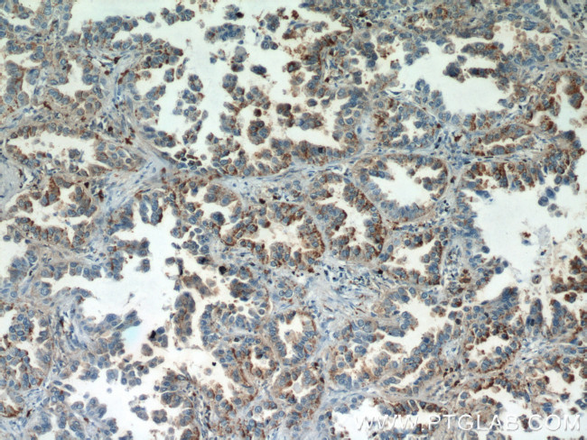 MYDGF Antibody in Immunohistochemistry (Paraffin) (IHC (P))