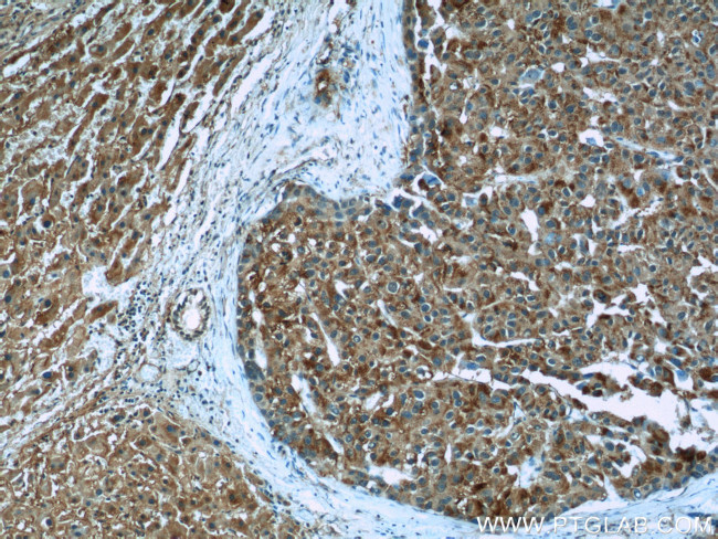 MYDGF Antibody in Immunohistochemistry (Paraffin) (IHC (P))