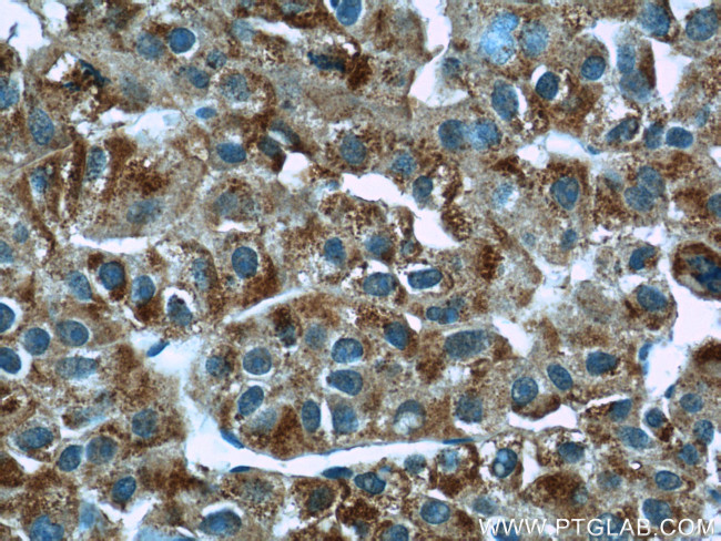 MYDGF Antibody in Immunohistochemistry (Paraffin) (IHC (P))