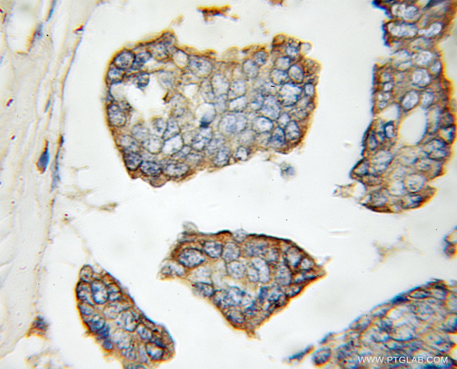 LGP2 Antibody in Immunohistochemistry (Paraffin) (IHC (P))