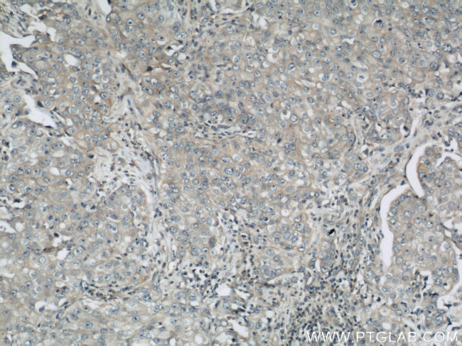 LGP2 Antibody in Immunohistochemistry (Paraffin) (IHC (P))