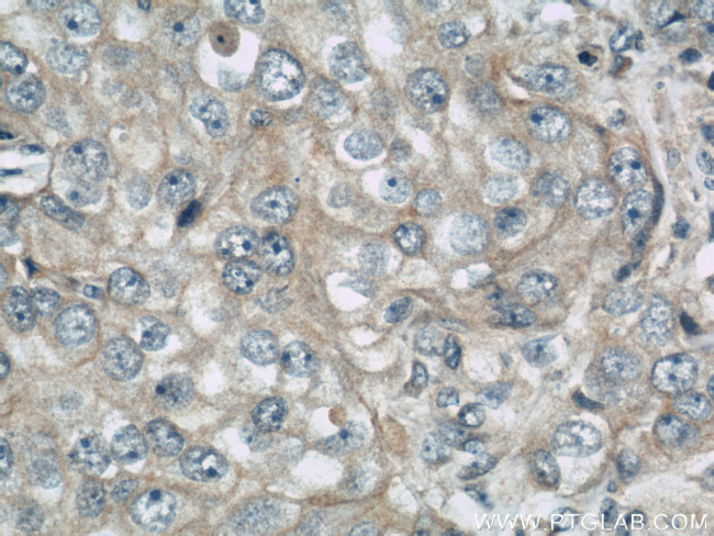 LGP2 Antibody in Immunohistochemistry (Paraffin) (IHC (P))